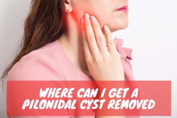 where can i get a pilonidal cyst removed