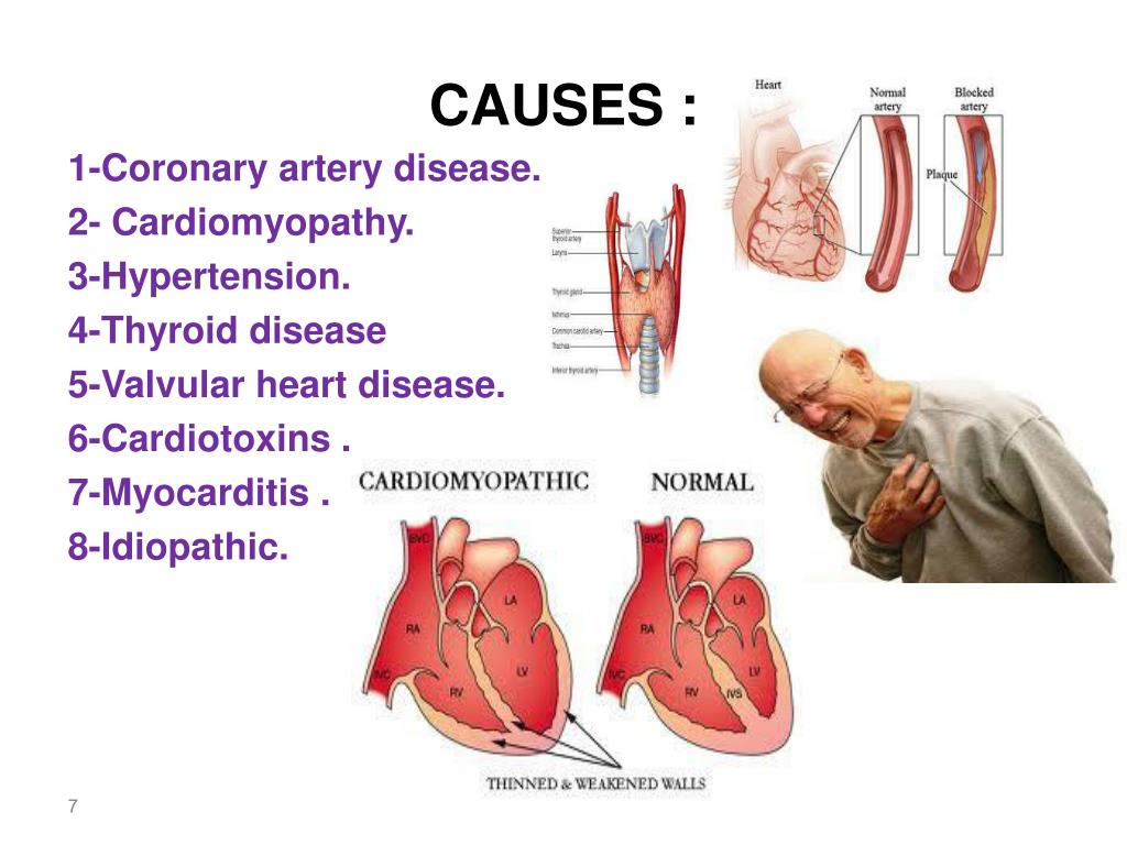 coronary artery disease treatments Cleveland TX